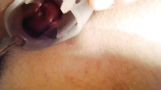 Long Bottle,long Sex Toys and Fist into Cunt,stretched,cervix Performance,pencil into Cervix