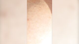 Old W/ Huge Toes inside Slippers Sunbathes her Cunt while