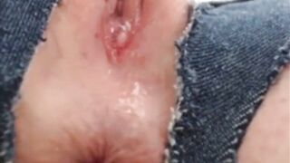Swollen Clitoris Edge with toy