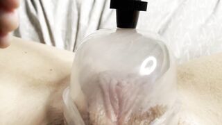 Cunt Pumping my Long Clitoris with my new Snatch Pump