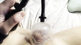 Cunt Pumping my Long Clitoris with my new Snatch Pump