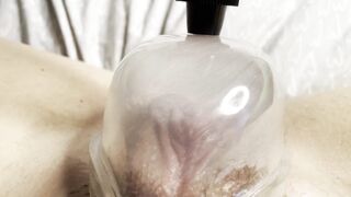 Cunt Pumping my Long Clitoris with my new Snatch Pump