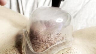 Cunt Pumping my Long Clitoris with my new Snatch Pump