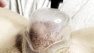 Cunt Pumping my Long Clitoris with my new Snatch Pump