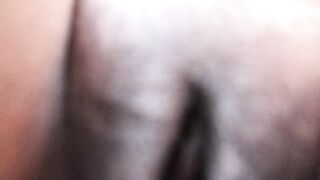 Oops, I Peed on the Camera