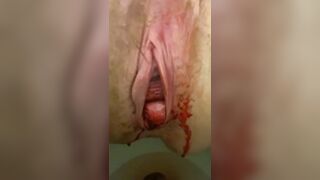 THE MONTHLY DRIP EXAMINE AND CLEANUP