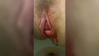 THE MONTHLY DRIP EXAMINE AND CLEANUP