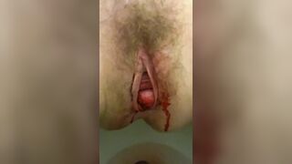 THE MONTHLY DRIP EXAMINE AND CLEANUP