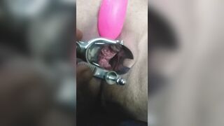 Close up Speculum and Internal Veiw of Squirting