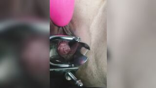 Close up Speculum and Internal Veiw of Squirting