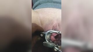 Close up Speculum and Internal Veiw of Squirting