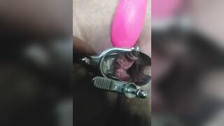 Close up Speculum and Internal Veiw of Squirting