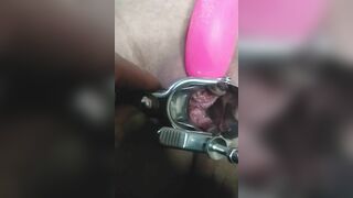 Close up Speculum and Internal Veiw of Squirting