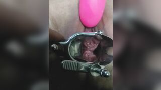 Close up Speculum and Internal Veiw of Squirting