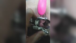 Close up Speculum and Internal Veiw of Squirting