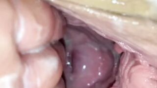 Huge Twat