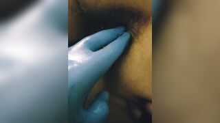 Small Disabled Whore Takes Anal Pounding from Nurse Painful