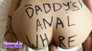 سکس ایرانی جدید / Persian 18 Yo sluts Anal Banged!. Sex Sub Love Penis inside her Butt.