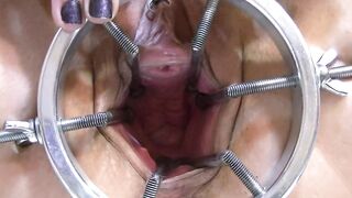 Ring Spreader inside my Snatch plus an Anal Plug