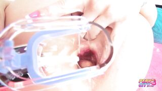 Anal Speculum Exam and Fucking