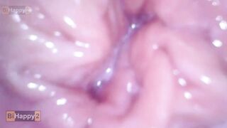 Jizzed Servix Camera into Snatch Full of Sperm Multiorgasmic sluts FULL
