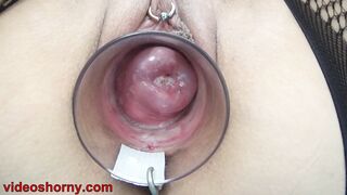 Japanese Cervix Fucking With Dick Sex Toy And chinese Chopsticks