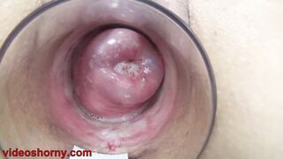 Japanese Cervix Fucking With Dick Sex Toy And chinese Chopsticks