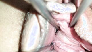 Vagina spreader 