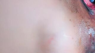 SEE MY RED PULSATING ANAL PROLAPSE