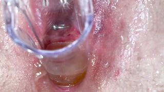 He pissing in my twat by speculum and I squirt