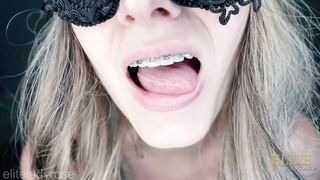 Joi for braces