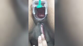 expanding my asshole