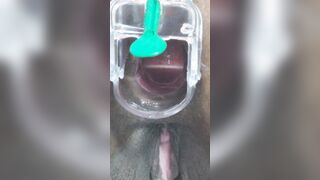 expanding my asshole