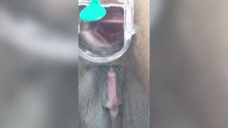 expanding my asshole