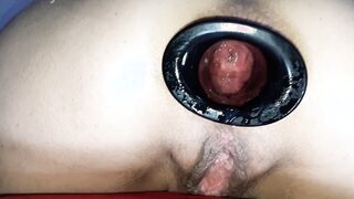 Kinky Alice asshole, Gape into