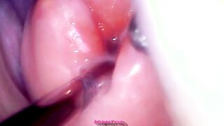 AdalynnX - Look Inside My Cervix Endoscope Watch
