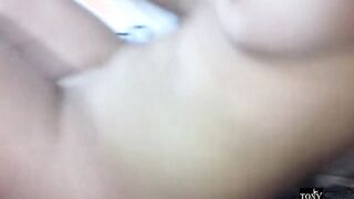 She shows off her caesarean section, assuring me that her