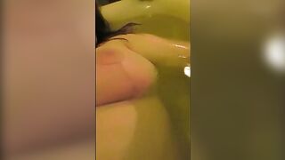 Progression of my hooters surgery, from an E-F cup to a huge C