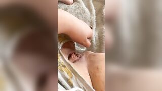 First long anal