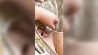 First long anal
