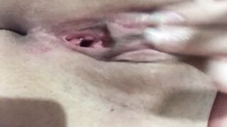 Do you want to Remove your Tummy?