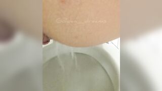 Anal gas from huge anus