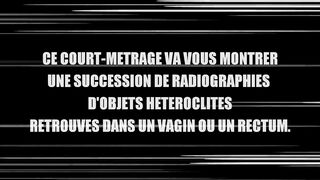 Top 10 - En Profondeur