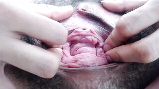 Pervert Files: teen yo YO Prolapsed Hairy Cunt Meat