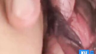 Hairly pussy of Japanese MILF