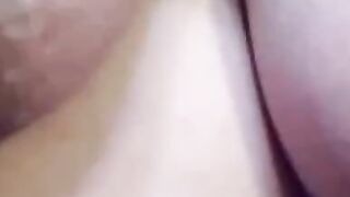 pregnant areola