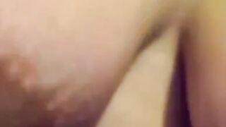 pregnant areola