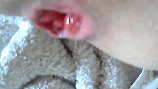 First Time Knotting My BD Toy - Gaping Twink