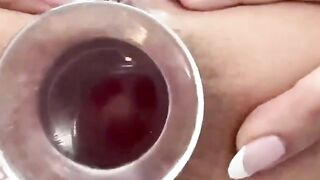 Privado 344