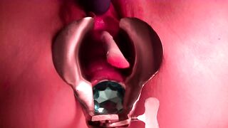 Hugest Anal Plug, Speculum, Sounding Fun, and Pee